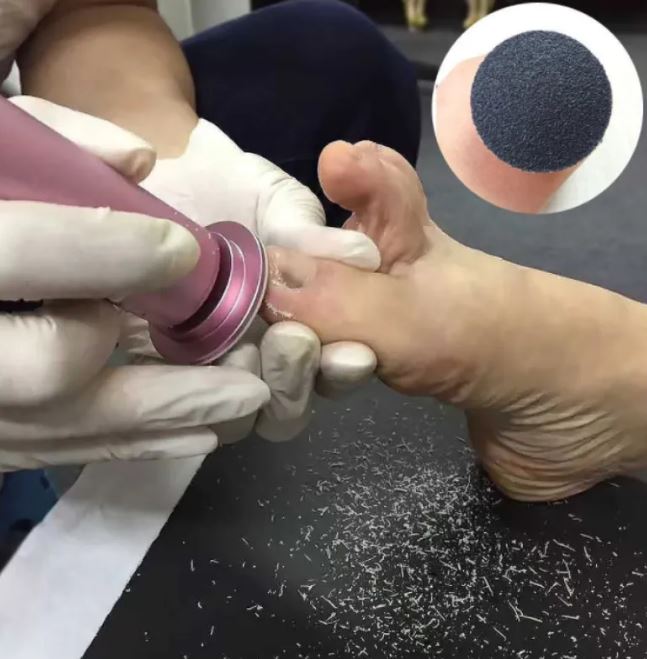 Electric Pedicure Foot-Care Tool – product view 1
