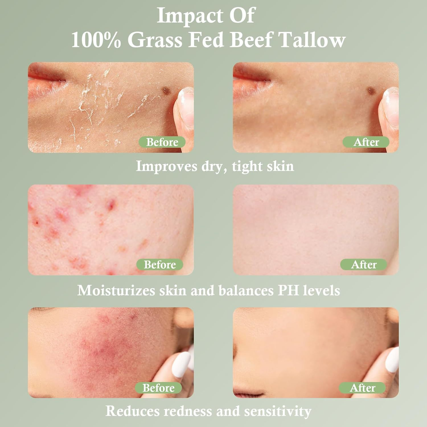 Grass-Fed Tallow Moisturizing Cream