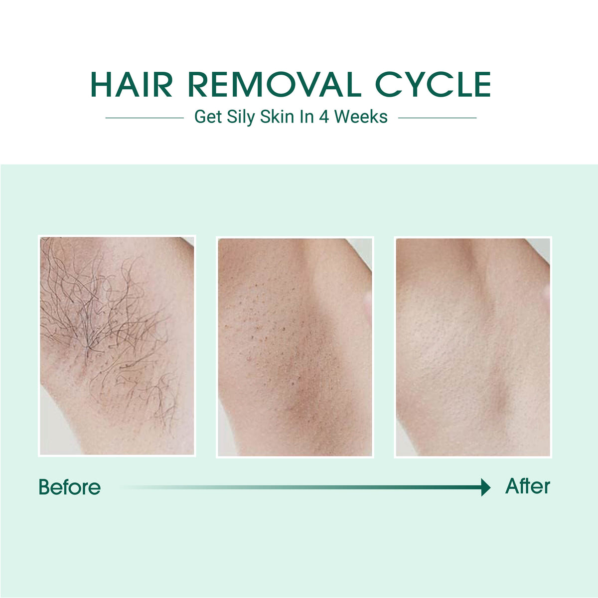 Zenvia Beauty IPL Hair Removal Device with sleek design and treatment window for painless hair removal at home